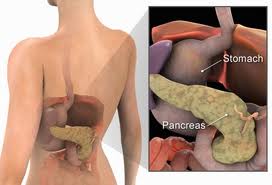 Obat kanker pankreas alami